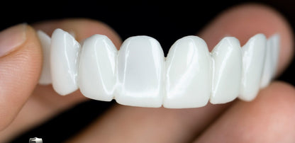 Removable Cosmetic Dental Veneer for Natural Looking Smile