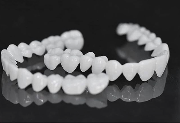 Removable Cosmetic Dental Veneer for Natural Looking Smile