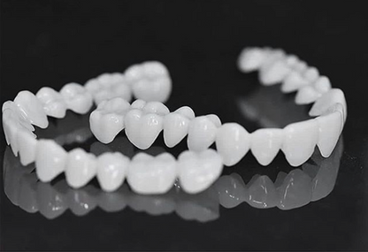 Removable Cosmetic Dental Veneer for Natural Looking Smile