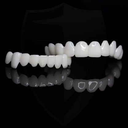 Removable Cosmetic Dental Veneer for Natural Looking Smile